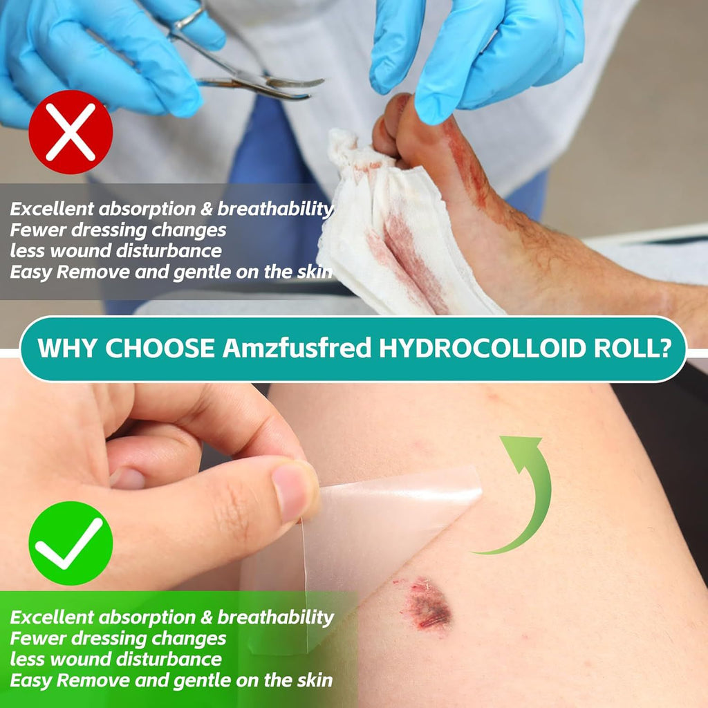Cross-Border Hydrocolloid Dressing Roll Wound Care Dressing Absorbent Exudate Band-Aid Hydrocolloid Roll